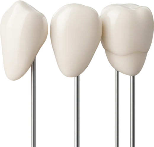 A set of porcelain veneers